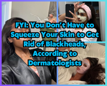 FYI: You Don’t Have to Squeeze Your Skin to Get Rid of Blackheads, According to Dermatologists